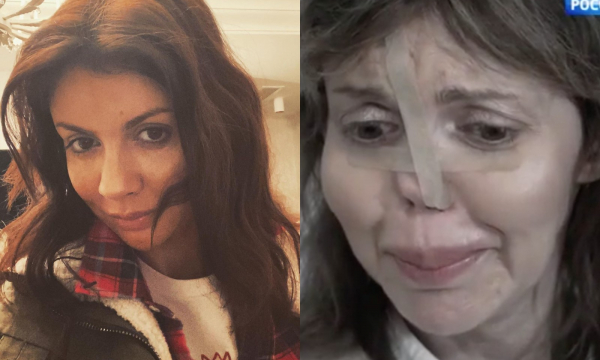 Бывшая жена Аршавина рассказала правду, что изуродовало её